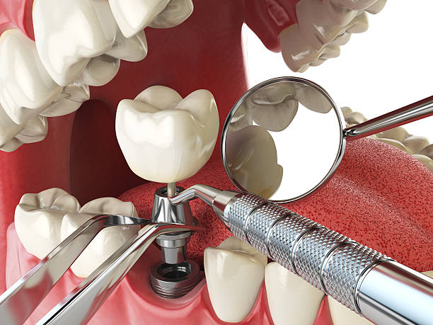 Best Emergency Dental Care for Trauma or Injury in Garrett, IN